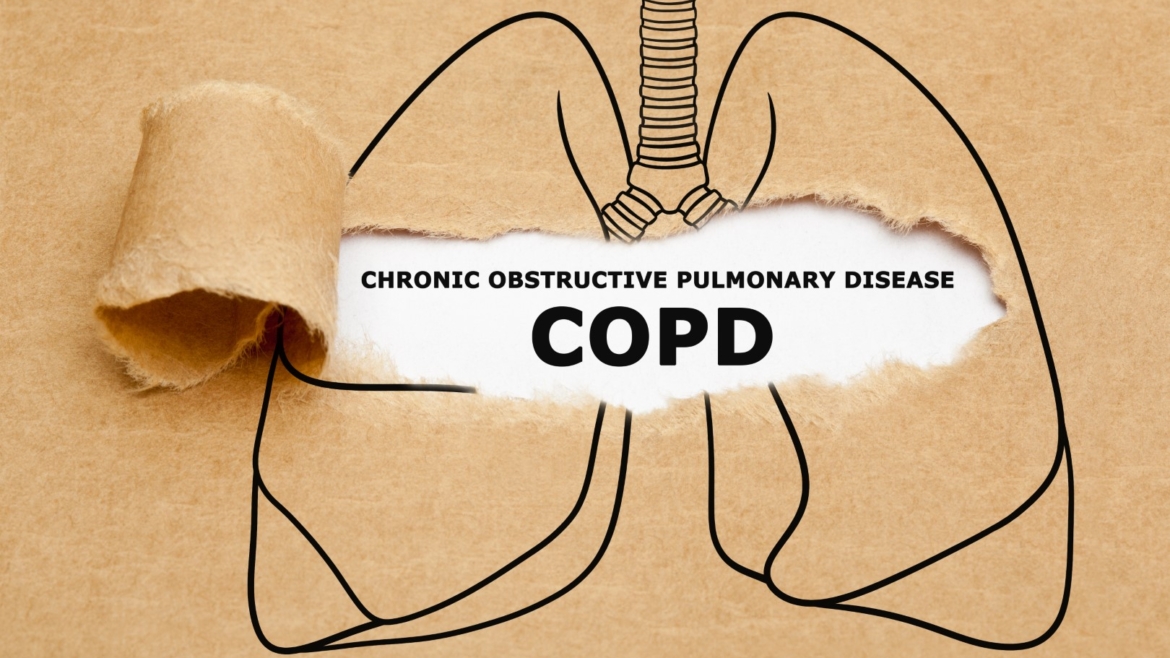 How to Choose the Best Medical Equipment for COPD